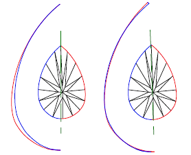 Girdle asymmetry and recommendation for removing